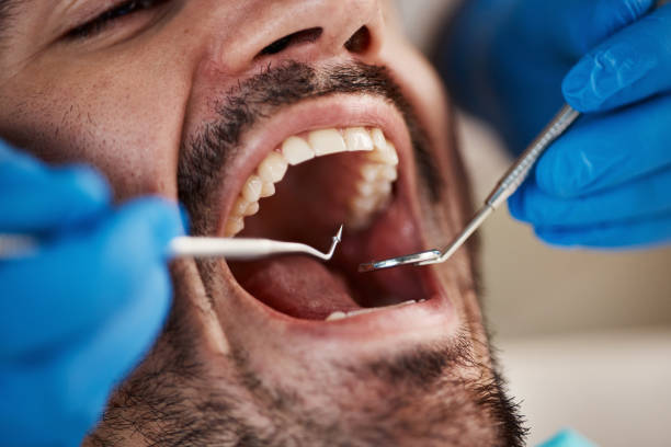 Emergency Dental Services in Harrison, OH